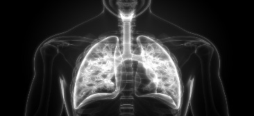 Pulmonary Embolism I